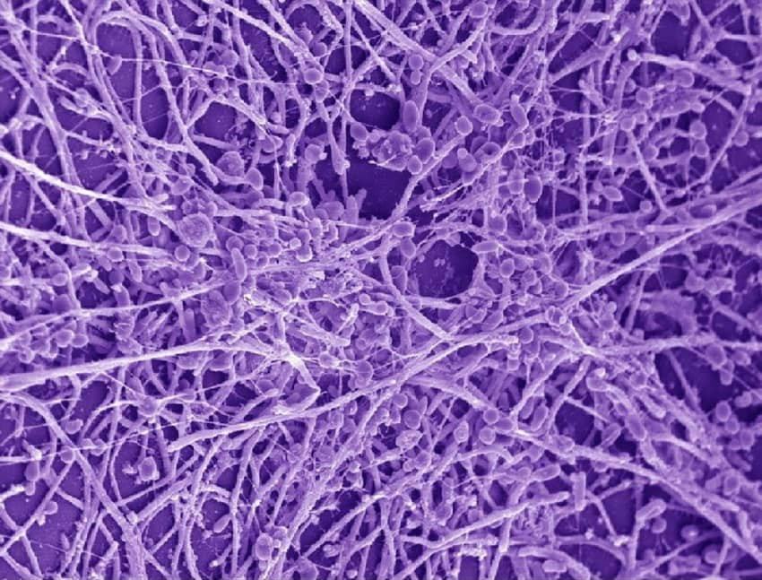 Tinea Capitis: Background, Pathophysiology, Etiology